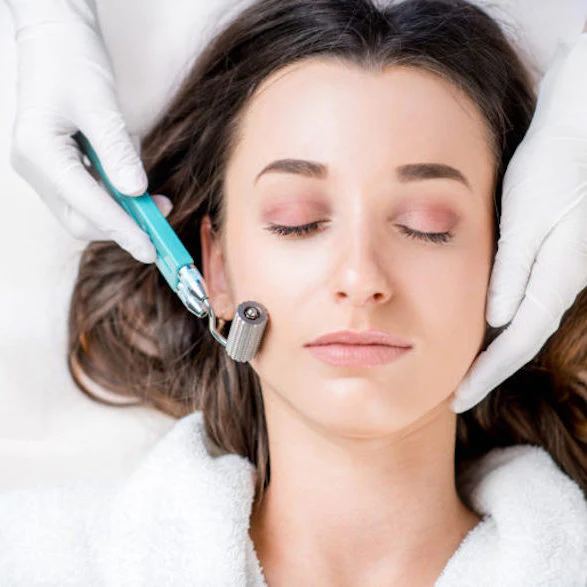 Microneedling at Burlington Spa